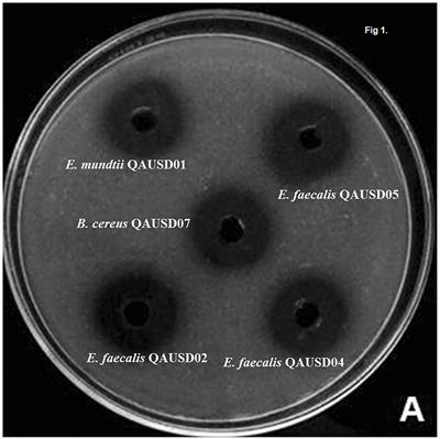 Wheat Fermentation With Enterococcus mundtii QAUSD01 and Wickerhamomyces anomalus QAUWA03 Consortia Induces Concurrent Gliadin and Phytic Acid Degradation and Inhibits Gliadin Toxicity in Caco-2 Monolayers